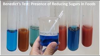 BENEDICTS TEST Presence of Reducing Sugars in Foods [upl. by Oenire]