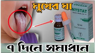 Nystat Oral Suspension।।How To Use Nystat।।মুখের ঘা দূর করার সেরা ঔষধNystst Drop [upl. by Ashly]