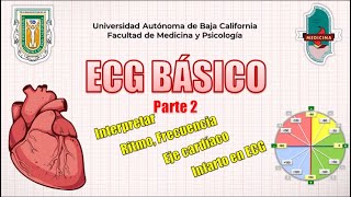 Aprende a interpretar ECG Básico Rápido y Sencillo  Parte 2  GUÍA RESUMIDA [upl. by Anivol213]