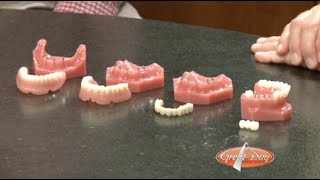 Mini Dental Implants How They Work [upl. by Paik]