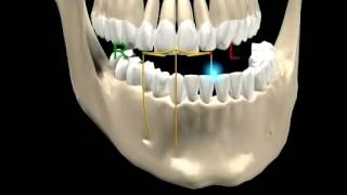 Movimientos mandibulares en el plano frontal [upl. by Hocker]