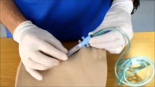 Needle Cricothyroidotomy [upl. by Caz]