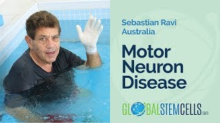 Motor Neuron Disease Patient From Australia Sebastian Feels Stronger after Stem Cell Treatment [upl. by Neeloc237]