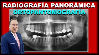 RADIOGRAFIAS PANORAMICAS DENTALES INTERPRETACION EN ORTODONCIA [upl. by Ran305]