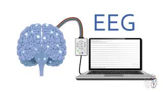 QEEG Brain Scans Explained [upl. by Inneg]