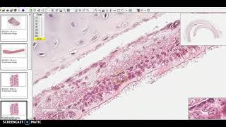 Hyaline elastic and fibrocartilage how to identify under microscope cartilage histology anatomy [upl. by Neerehs]