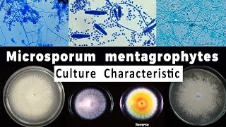 Trichophyton mentagrophytes culture Characteristic [upl. by Bree822]