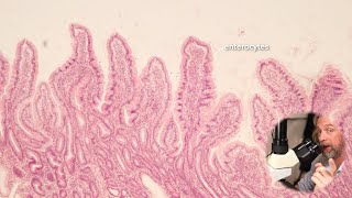 Microscopic anatomy of the small intestine [upl. by Nylkaj]