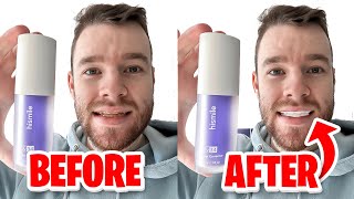 HiSmile v34 Colour Corrector  Get White Teeth Easy  Honest Review [upl. by Wendalyn]