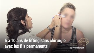 LIFTING SANS CHIRURGIE  Pose des fils tenseurs permanents Thread amp Lift [upl. by Lj777]