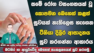 කොපමණ බෙහෙත් කලත් සුව නොවන ටීනියා දිලීර ආසාදනය සුව කර ගනිමු  Treatments For Tinea Fungal Infection [upl. by Sandro]