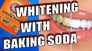 How To Easily WHITEN Your TEETH With BAKING SODA [upl. by Notlil]