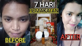 PENGALAMAN 7 HARI BEBERAPA ORANG MENGGUNAKAN TABITA SKIN CARE ORIGINAL  REAL TESTIMONI [upl. by Ed]