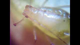 Greenfly or Aphid  Aphidoidea [upl. by Carita]