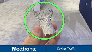 Medtronic Evolut Transcatheter Aortic Valve Replacement TAVR at TCT 2023 [upl. by Schonfield]