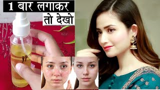 Lemon Leaves Toner चेहरे के बारीक दाने पिम्पल के दाग हटाकर चेहरा गोरा चमकदार बना देगा [upl. by Clovah]