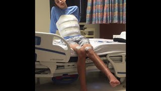 Spinal Cord Injury Recovery Video 11 [upl. by Elocim610]