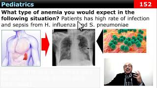 internalmedicine cme usmle محاضراتباطنة ecg كورساتباطنة clinical clinical medicine [upl. by Llamaj29]