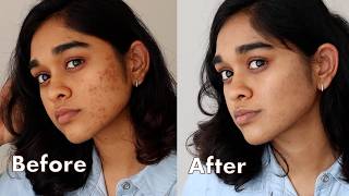 Minimal Makeup to Cover Acne Scars for BrownIndian Skin very demure very cutesy [upl. by Seraphim57]