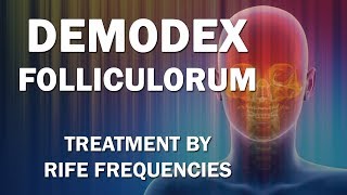 Demodex Folliculorum  RIFE Frequencies Treatment  Energy amp Quantum Medicine with Bioresonance [upl. by Otnas]