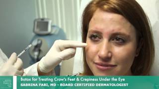 Botox for Crows Feet  Botox Around Eyes  Dr Fabi [upl. by Questa56]