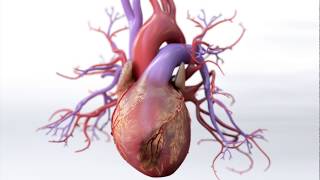 What is Coronary Artery Disease  Mechanism of Disease [upl. by Alison]