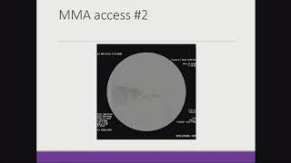 SVIN 2019 IntraArterial Chemotherapy for Retinoblastoma  How to Do It [upl. by Ecylahs838]