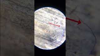 NAILS 🤢🤮 Under Microscope shorts microscope science [upl. by Niac]