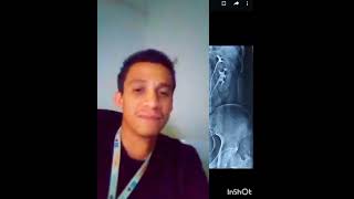 VIDEO PODCAST UROGRAFIA INTRAVENOSA repaso y análisis [upl. by Yelhak689]