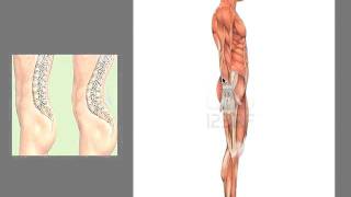 What Is Lordosis [upl. by Asira]