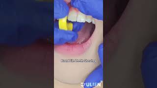 Hand Filing Your Teeth braces ipr asmr [upl. by Naicul]