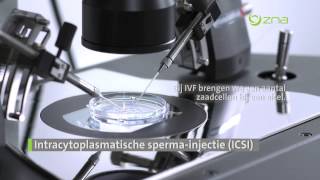 ZNA Fertiliteitscentrum Intracytoplasmatische spermainjectie [upl. by Lyrehs]