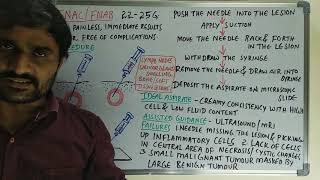 Fine Needle Aspiration Cytology [upl. by Eirahcaz357]