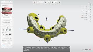 3Shape Implant Studio  Caso de Edentados  Como projetar um guia cirúrgico [upl. by Saerdna]