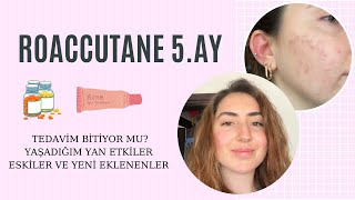 ROACCUTANE 5AY I tedavim ne zaman bitecek [upl. by Nnahteb]