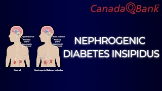 Nephrogenic Diabetes Insipidus [upl. by Aehta]