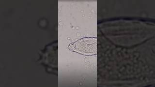 schistosoma haematobium in urine slide test viral shorts [upl. by Leimaj]