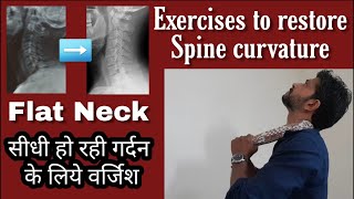 How to restore cervical curve  Exercises for straightening of cervical spineLoss of Lordosis [upl. by Atsillac]