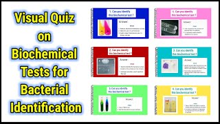 Visual Quiz on Biochemical tests for identification of bacteria  basicappliedmicrobiology [upl. by Adabelle]