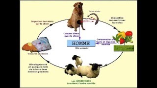 PNEUMOLOGIE kyuste hydatique du poumon 2015 [upl. by Clementi]