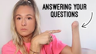 Answering Your Questions About My Amputated Arm  Amputee QampA [upl. by Yrroc649]