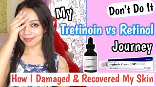 My Tretinoin vs Retinol Journey Tretinoin cream 0025 Minimalist Retinol 03 serum Before amp after [upl. by Cotterell956]