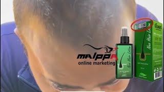 Neo Hair Lotion malayalam customer feedback by Malppa Studio [upl. by Salhcin]