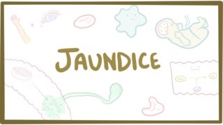 Jaundice  causes treatment amp pathology [upl. by Yde49]