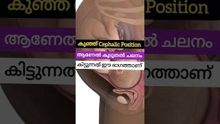 Cephalic positionBaby Movement Malayalampregnancy fetalkick [upl. by Roe]