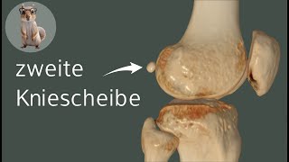 Die zweite Kniescheibe  die Fabella anatomie medizin anatomy [upl. by Adnolay670]