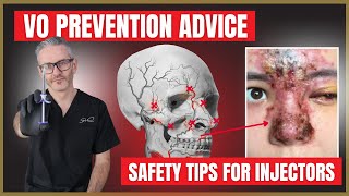 Vascular Occlusion amp Necrosis Prevention  Dermal Filler Safety Advice for Injectors [upl. by Huan]