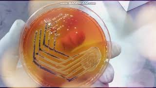 Xylose Lysine Deoxycholate agar  XLD  Selective medium for Salmonella and Shigella [upl. by Aihsemaj]