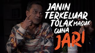 Janin terkeluar tolak masuk pakai jari  Kita Like Podcast BUDI [upl. by Yenhoj]