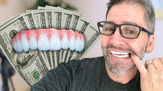 How I Saved On Dental Implants Without Going Overseas [upl. by Aubry]